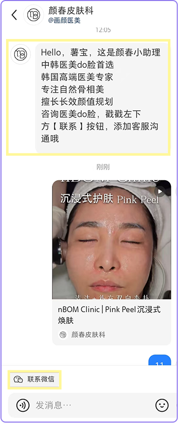 자동 응답 메세지